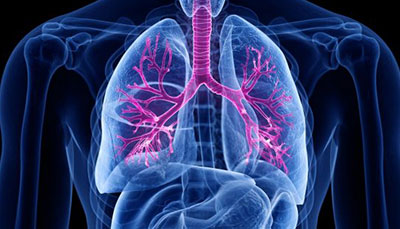 什么是慢性阻塞性肺病 (Chronic Obstructive Pulmonary Disease)，為何與新冠疫情有關(guān)？